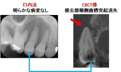 口腔顎顔面放射線・画像診断学講座　写真